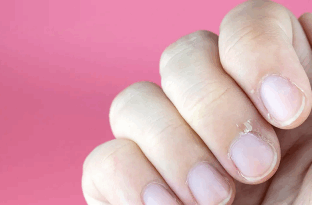 Beruhigt Kratzer in den Nägeln Nagelpflege mit Kokosöl